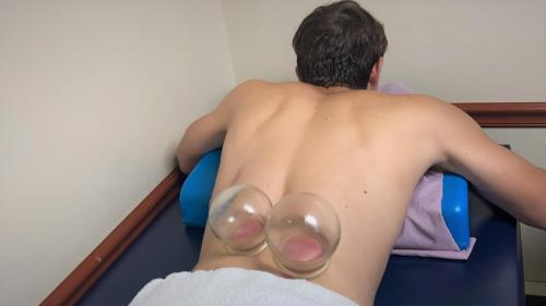 cupping2_res